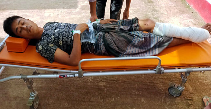 মিয়ানমার সীমান্তে ‘ল্যান্ড মাইন’ বিস্ফোরণে উড়ে গেল বাংলাদেশি যুবকের পা
