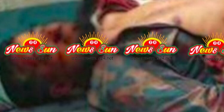 বেনাপোলের পুটখালি সীমান্তে মোটরসাইকেল দুর্ঘটনায় বিজিবি সদস্য নিহত