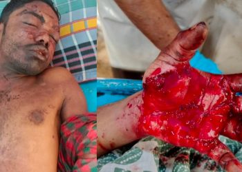 শার্শায় ককটেল বিস্ফোরণে যুবক গুরুতর আহত